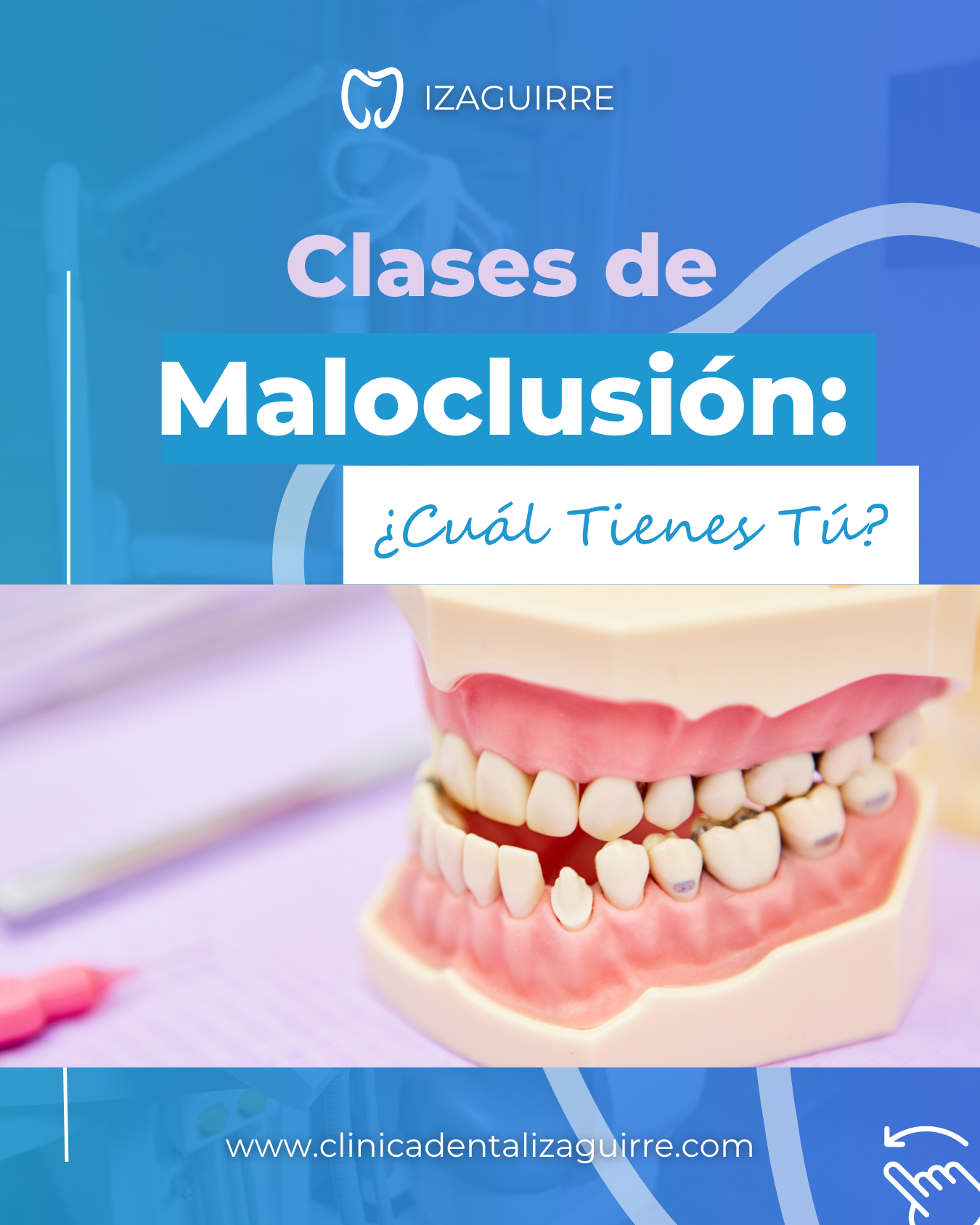 Portada · Clases de maloclusión: ¿cuál tienes tú?