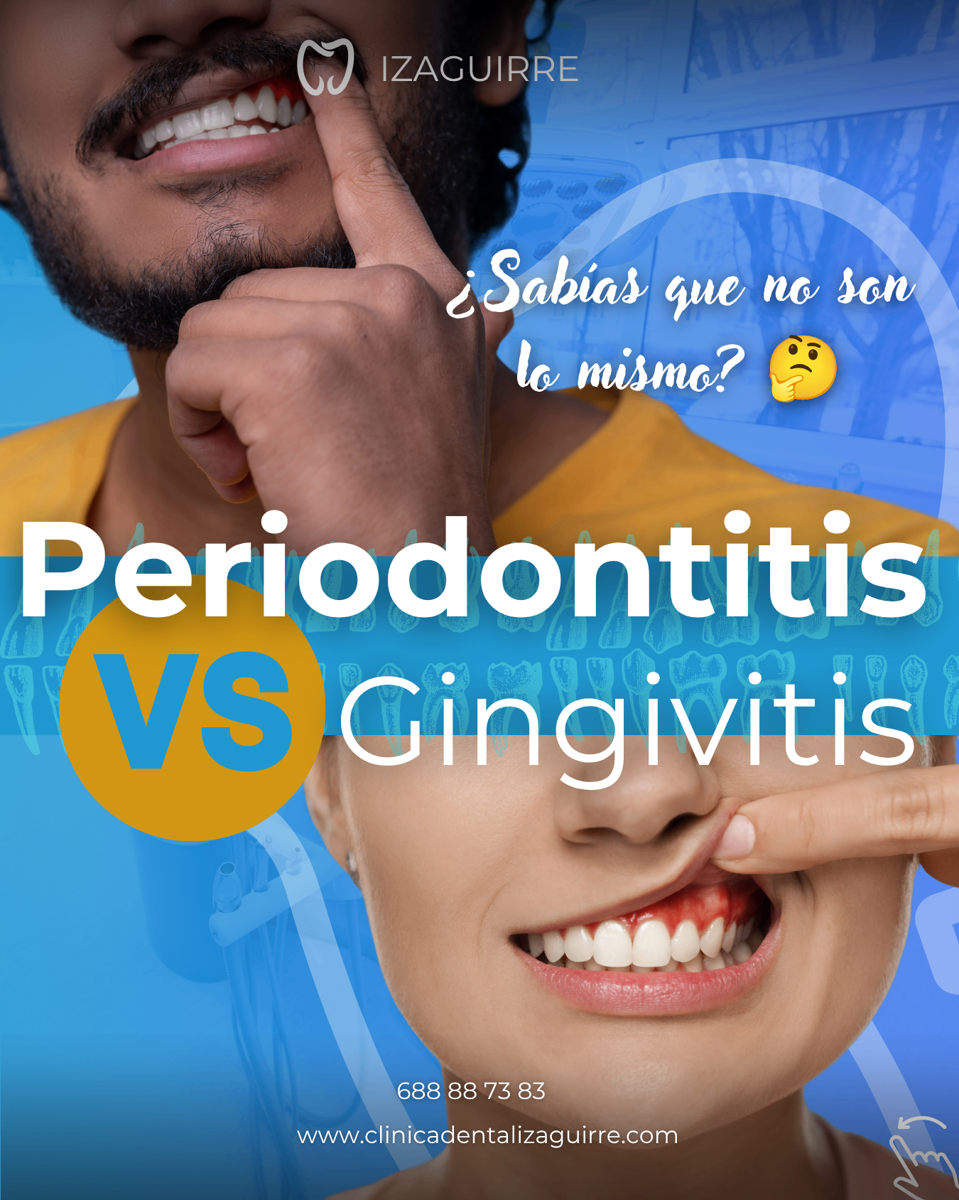 Portada · Periodontitis vs Gingivitis